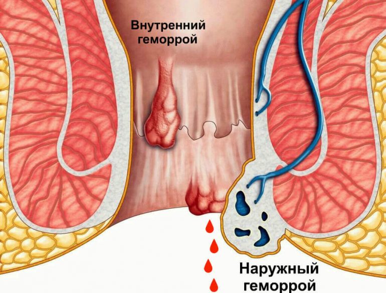 Виды заболеваний 