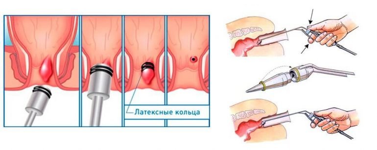 Суть метода