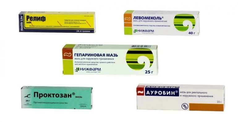Лечение геморроя
