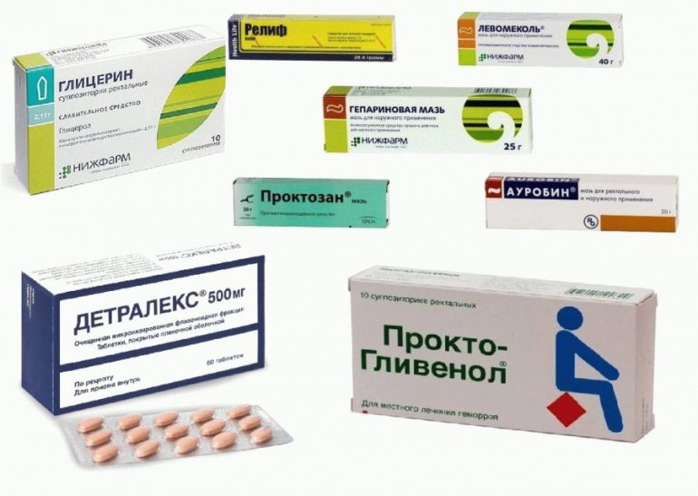 Лечение острого геморроя