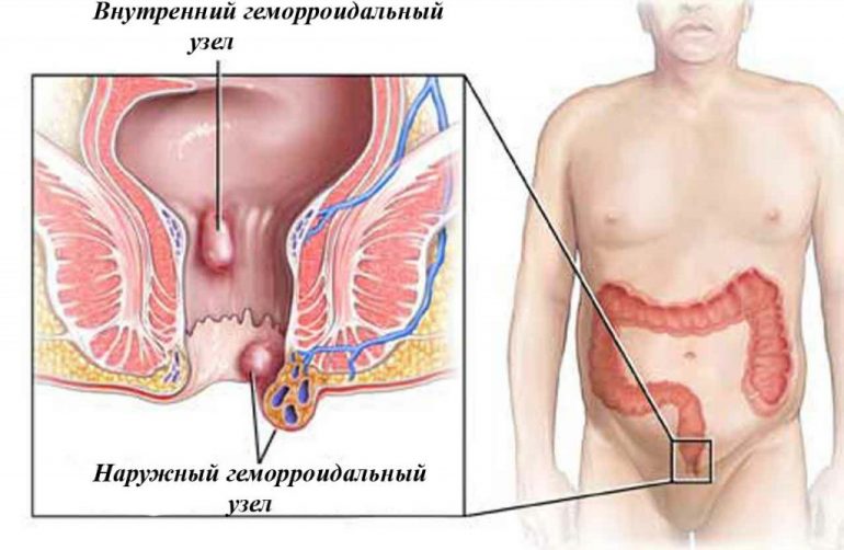 Показания и противопоказания