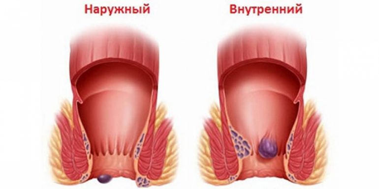 Целительные состав и лечебные свойства пижмы