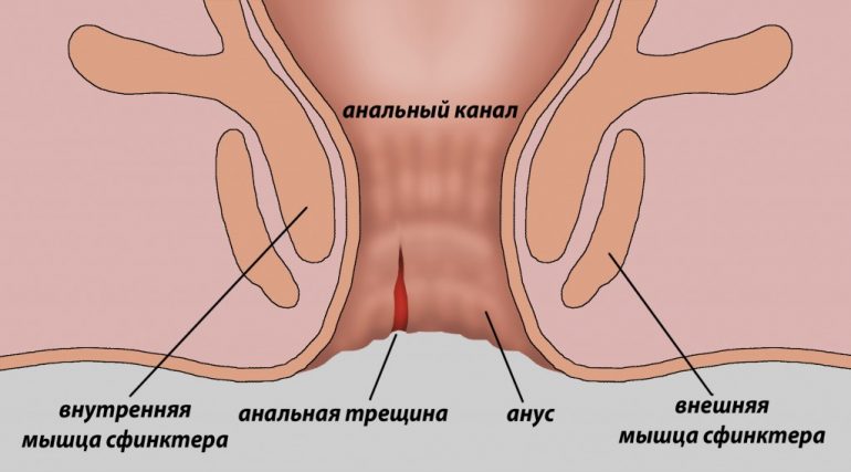 Возможные причины 