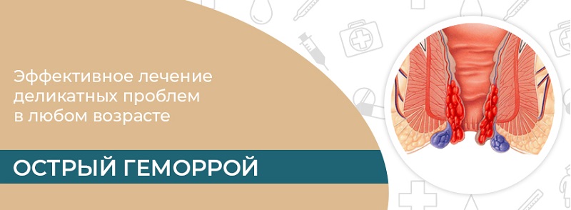 острый геморрой